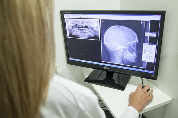 Онкологи не согласны со страшной статистикой смертности от рака