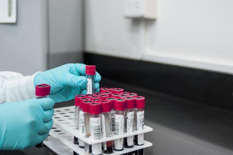 WADA сможет получать любые допинг-пробы без предварительного запроса