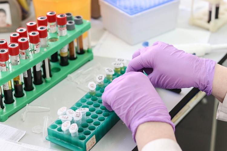 В России за сутки выявили 1154 новых случая заражения COVID-19