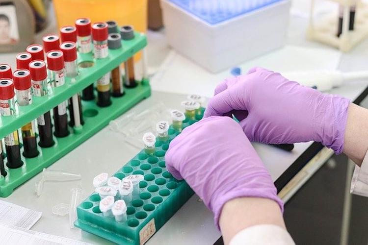 В Новосибирской области количество заболевших COVID-19 выросло до 1,2 тысячи