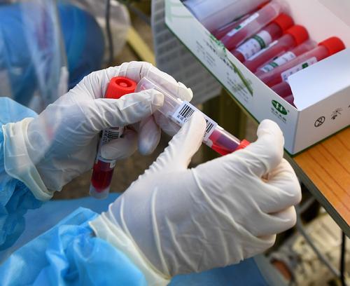 Медики: смертность из-за COVID-19 в США может на 15% превышать официальные данные