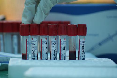 В России за сутки выявили 6 611 случаев заражения COVID-19