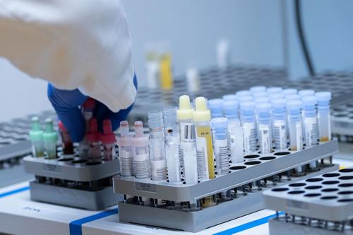 Количество выявленных случаев заражения COVID-19 в мире превысило 21 миллион