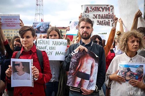 В Сети появился ролик, доказывающий как сильно «никого не били» в белорусском изоляторе на Окрестина