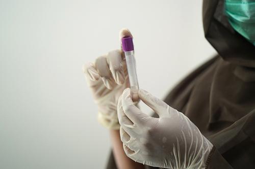 В России зафиксировано самое большое число смертей от коронавируса за сутки за период пандемии COVID-19