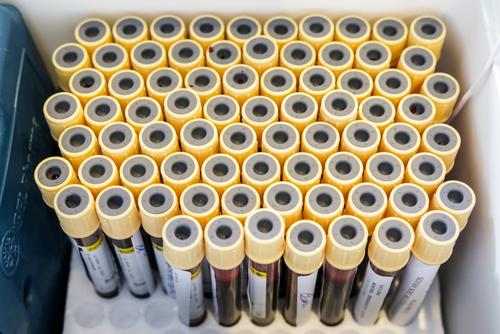 В России за сутки выявили 21 734 случая заражения COVID-19