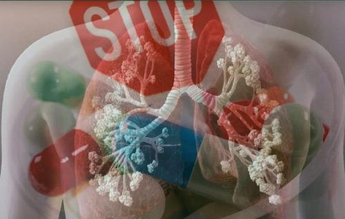 Дети с редким заболеванием могут остаться без помощи фонда «Круг добра»