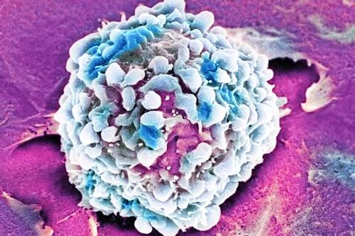 Разработана модель роста раковой опухоли