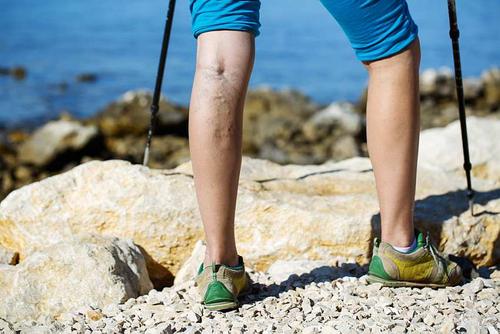 Ноги свело: сказывается чрезмерно активный ритм жизни