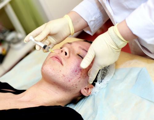Эксперт Черемушкин назвал несколько способов распознать рак кожи