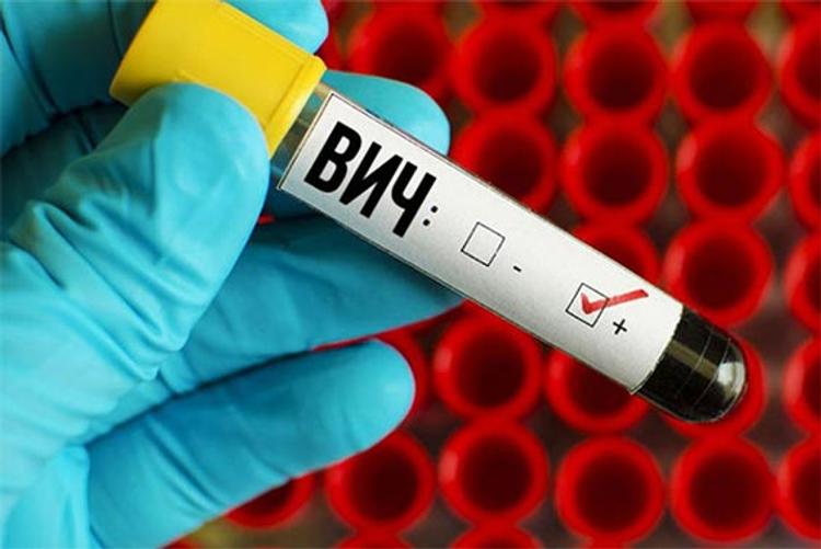 В Иркутске ВИЧ идет на убыль