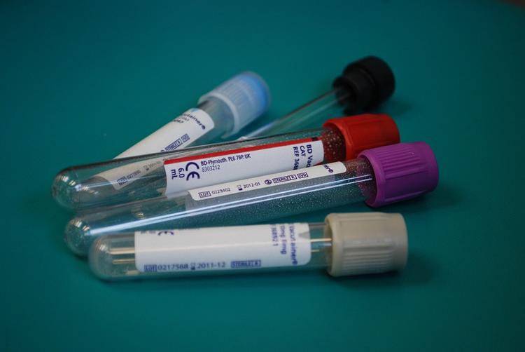Медики научились по новому тесту крови определять дату смерти человека