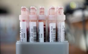 ВОЗ выявила рекордный рост числа заражений коронавирусом за неделю в мире - более 2,4 млн