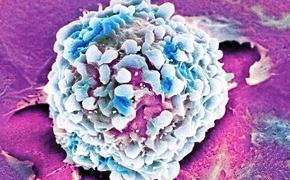 Разработана модель роста раковой опухоли