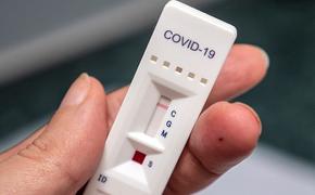 Кожный тест позволит определить необходимость ревакцинации от COVID